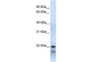 POLR3H antibody used at 1 ug/ml to detect target protein. (POLR3H antibody  (Middle Region))