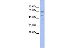 WB Suggested Anti-GNL3 Antibody Titration: 0. (Nucleostemin antibody  (N-Term))