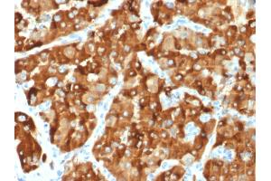 Immunohistochemistry (IHC) image for anti-alpha-Methylacyl-CoA Racemase (AMACR) (AA 297-394) antibody (ABIN6939431)