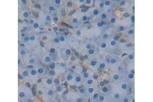 IHC-P analysis of Human Tissue, with DAB staining. (IL13RA2 antibody  (AA 238-334))