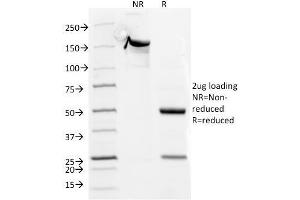 SDS-PAGE Analysis Purified CD5 Mouse Monoclonal Antibody (CD5/54/F6). (CD5 antibody)
