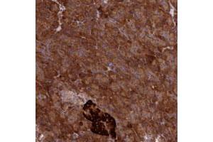 Immunohistochemical staining of human pancreas with DDX60L polyclonal antibody  shows strong cytoplasmic positivity in exocrine glandular cells at 1:50-1:200 dilution. (DDX60L antibody)