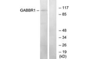 Western blot analysis of extracts from K562 cells, using GABBR1 Antibody. (GABBR1 antibody  (AA 891-940))