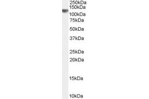 Western Blotting (WB) image for anti-Endomucin (EMCN) (N-Term) antibody (ABIN2156755) (Endomucin antibody  (N-Term))