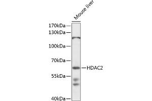 Western blot analysis of extracts of mouse liver, using HD antibody  at 1:1000 dilution. (HDAC2 antibody  (AA 429-488))
