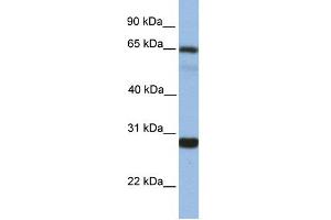 WB Suggested Anti-MED4 Antibody Titration:  1 ug/ml  Positive Control:  Fetal liver cell lysate (MED4 antibody  (Middle Region))