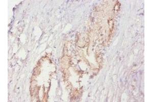 Immunohistochemistry of paraffin-embedded human prostate tissue using ABIN7164895 at dilution of 1:20 (ACPP antibody  (AA 38-386))