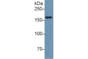 Detection of NOS1 in Mouse Cerebrum lysate using Polyclonal Antibody to Nitric Oxide Synthase 1, Neuronal (NOS1) (NOS1 antibody  (AA 9-136))