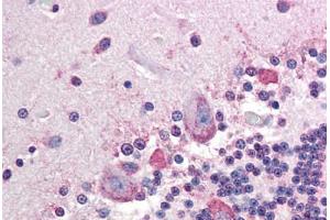 Human Brain, Cerebellum (formalin-fixed, paraffin-embedded) stained with ALPP antibody ABIN296659 at 10 ug/ml followed by biotinylated anti-mouse IgG secondary antibody ABIN481714, alkaline phosphatase-streptavidin and chromogen. (PLAP antibody)