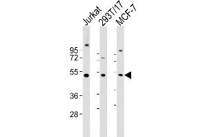 Western Blot at 1:2000 dilution Lane 1: Jurkat whole cell lysates Lane 2: 293T/17 whole cell lysates Lane 3: MCF-7 whole cell lysates Lysates/proteins at 20 ug per lane. (VRK1 antibody  (AA 366-396))