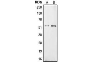 Western blot analysis of Carboxypeptidase E expression in NIH3T3 (A), PC12 (B) whole cell lysates.