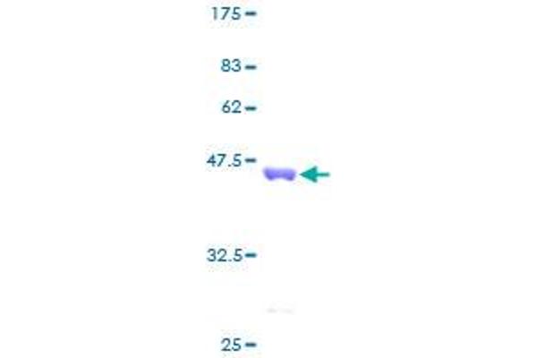 CCL13 Protein (AA 1-98) (GST tag)