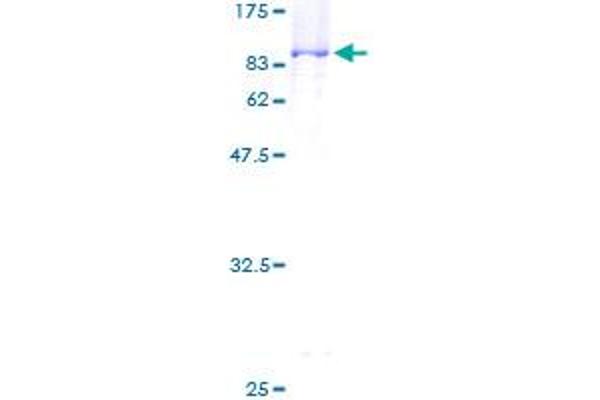 RNMT Protein (AA 1-476) (GST tag)