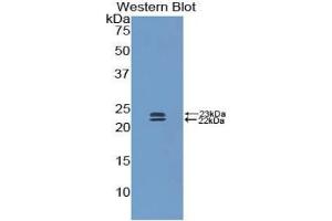 Western blot analysis of the recombinant protein. (BMP1 antibody  (AA 856-982))