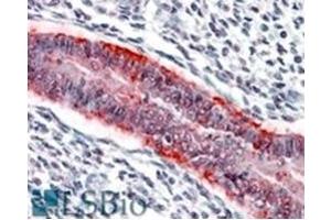 Image no. 1 for anti-Matrix Metallopeptidase 7 (Matrilysin, Uterine) (MMP7) (C-Term) antibody (ABIN374597) (MMP7 antibody  (C-Term))