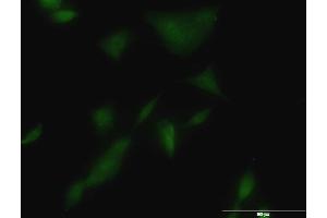 Immunofluorescence of monoclonal antibody to KLK3 on A-549 cell. (Prostate Specific Antigen antibody  (AA 1-261))