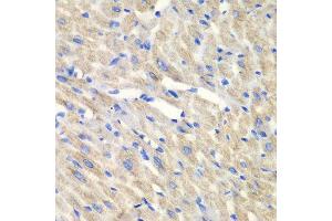 Immunohistochemistry of paraffin-embedded mouse heart using CARS antibody at dilution of 1:100 (x40 lens). (CARS antibody)