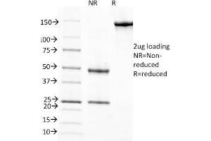 SDS-PAGE Analysis Purified RBP1 Mouse Monoclonal Antibody (G4E4). (RBP4 antibody)