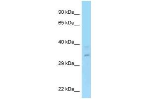 WB Suggested Anti-RPRD1A Antibody Titration: 1.