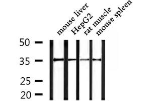 Western blot analysis of extracts from mouse liver and HepG2 and rat muscle and mouse spleen, using OR4F15 Antibody. (OR4F15 antibody)
