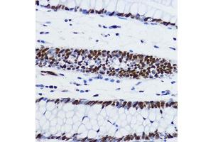 Immunohistochemistry of paraffin-embedded human colon using Acetyl-Histone H2B-K12 antibody (ABIN7267731) at dilution of 1:200 (40x lens). (Histone H2B antibody  (acLys12))