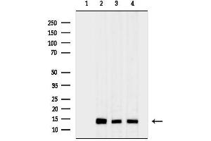 anti-Chromosome 1 Open Reading Frame 151 (C1orf151) antibody