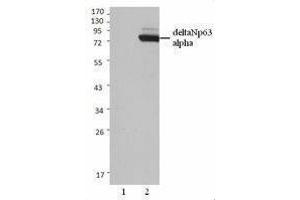 Western Blotting (WB) image for anti-T-Complex 1 (TCP1) antibody (ABIN2666194)