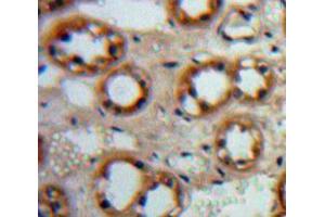 Used in DAB staining on fromalin fixed paraffin-embedded Kidney tissue (EGF antibody  (AA 977-1029))