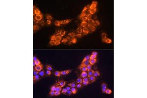 Immunofluorescence analysis of  cells using L Polyclonal Antibody (ABIN6128174, ABIN6143076, ABIN6143077 and ABIN6219002) at dilution of 1:100 (40x lens).