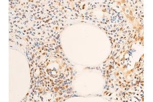 ABIN6256630 and ABIN6267283 at 1/100 staining rat appendiceal tissue sections by IHC-P. (ErbB2/Her2 antibody  (pTyr1248))
