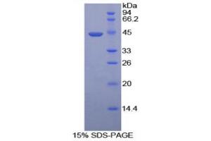 SDS-PAGE (SDS) image for Hyaluronidase-2 (HYAL2) (AA 23-447) protein (His tag) (ABIN1079890)