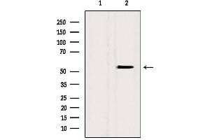 Western blot analysis of extracts from Hela, using BAMBI antibody. (BAMBI antibody  (Internal Region))