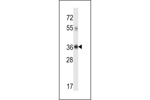 DHRS7C Antikörper  (AA 116-145)