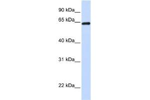 WB Suggested Anti-LCP1 Antibody Titration: 0. (LCP1 antibody  (C-Term))
