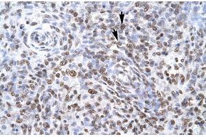 Human Spleen; ZNF500 antibody - middle region in Human Spleen cells using Immunohistochemistry