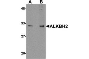 Western blot analysis of ALKBH2 in human kidney tissue lysate with ALKBH2 antibody at (A) 1 and (B) 2 μg/ml.