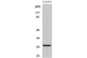 Western Blotting (WB) image for anti-Tumor Protein P53 Inducible Nuclear Protein 1 (TP53INP1) (C-Term) antibody (ABIN3187308) (TP53INP1 antibody  (C-Term))