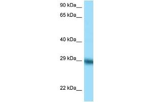 WB Suggested Anti-TFPI Antibody Titration: 1.