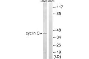 Western blot analysis of extracts from LOVO cells, using Cyclin C (Ab-275) Antibody.