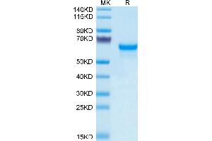 Human PRNP on Tris-Bis PAGE under reduced condition. (PRNP Protein (AA 23-230) (Fc Tag))