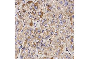 Immunohistochemistry (IHC) image for anti-Growth Arrest-Specific 2 (GAS2) (AA 1-100) antibody (ABIN6215372) (GAS2 antibody  (AA 1-100))