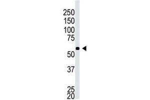 Western blot testing of BACE2C antibody and A549 cell lysate (BACE2C antibody  (AA 310-339))