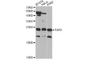 Western blot analysis of extracts of various cell lines, using TAF9 antibody (ABIN1875018) at 1:1000 dilution.