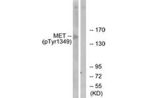 Western blot analysis of extracts from HepG2 cells, using Met (Phospho-Tyr1349) Antibody. (c-MET antibody  (pTyr1349))