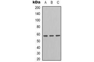 Western blot analysis of GRP58 expression in HT29 (A), K562 (B), A549 (C) whole cell lysates. (PDIA3 antibody)