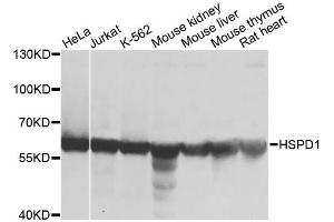 Western blot analysis of extracts of various cell lines, using HSPD1 antibody. (HSPD1 antibody)