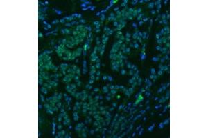 IF analysis of U1-C/SNRPC using anti-U1-C/SNRPC antibody (ABIN7599016). (SNRPC antibody  (AA 1-159))