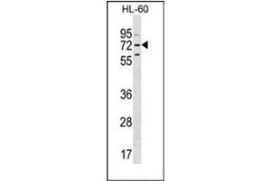 Western blot analysis of MBTD1 Antibody (C-term) in HL-60 cell line lysates (35ug/lane). (MBTD1 antibody  (C-Term))