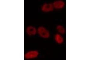 ABIN6275720 staining Hela by IF/ICC. (IKZF2 antibody  (Internal Region))