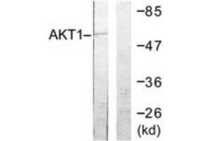 Western blot analysis of extracts from NIH-3T3 cells, treated with TNF-a 20ng/ml 30', using Akt (Ab-72) Antibody. (AKT1 antibody  (AA 38-87))